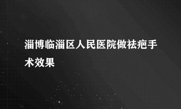 淄博临淄区人民医院做祛疤手术效果