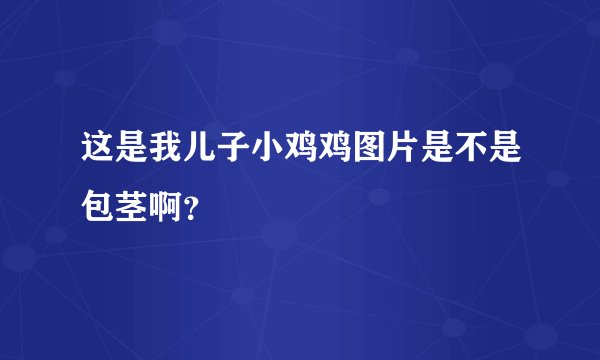 这是我儿子小鸡鸡图片是不是包茎啊？