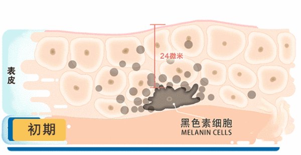 谁用过吉米和摩氧的祛斑产品,这些都是真的吗?那个更好一些