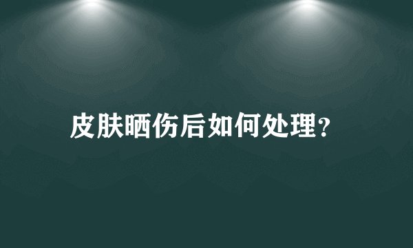 皮肤晒伤后如何处理？