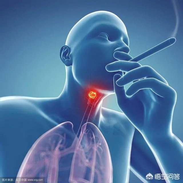 肺癌的的高危人群有哪些?