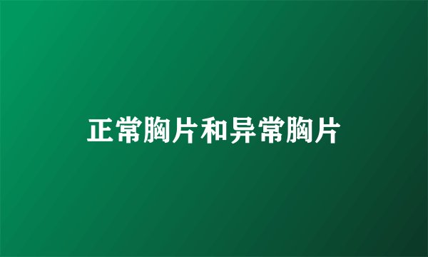 正常胸片和异常胸片