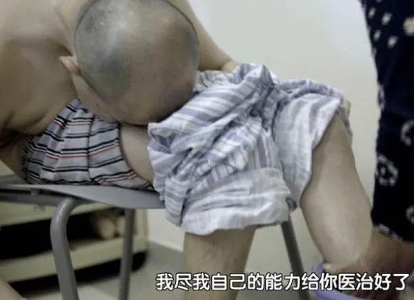 那个感动全国,被称作“折叠人”的李华,4次手术后现状怎样?