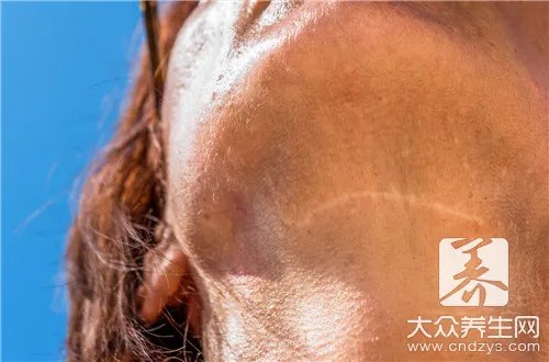  巴德维疗法